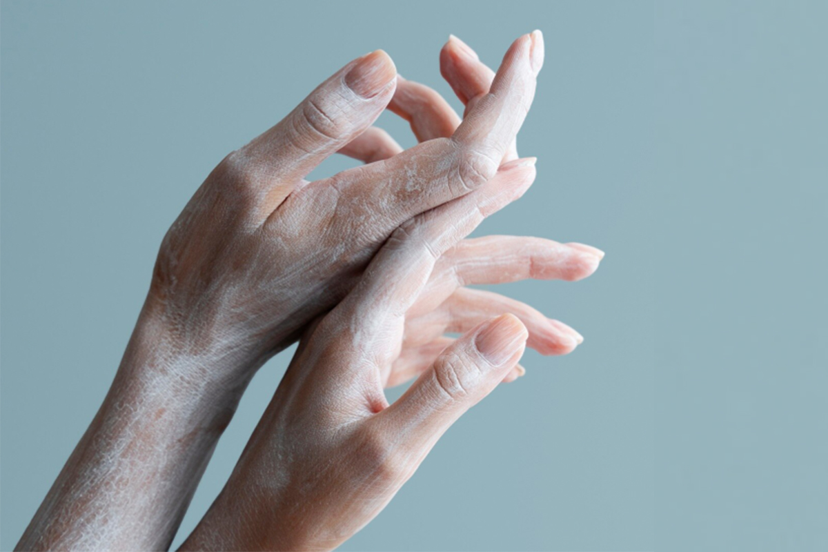 freepik_dry_skin_hand