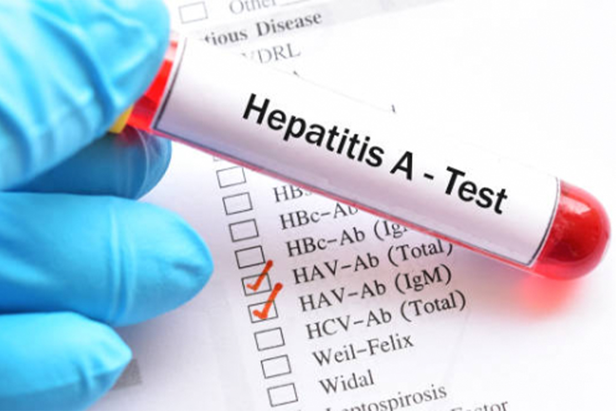 istock_hepatitis_a_test