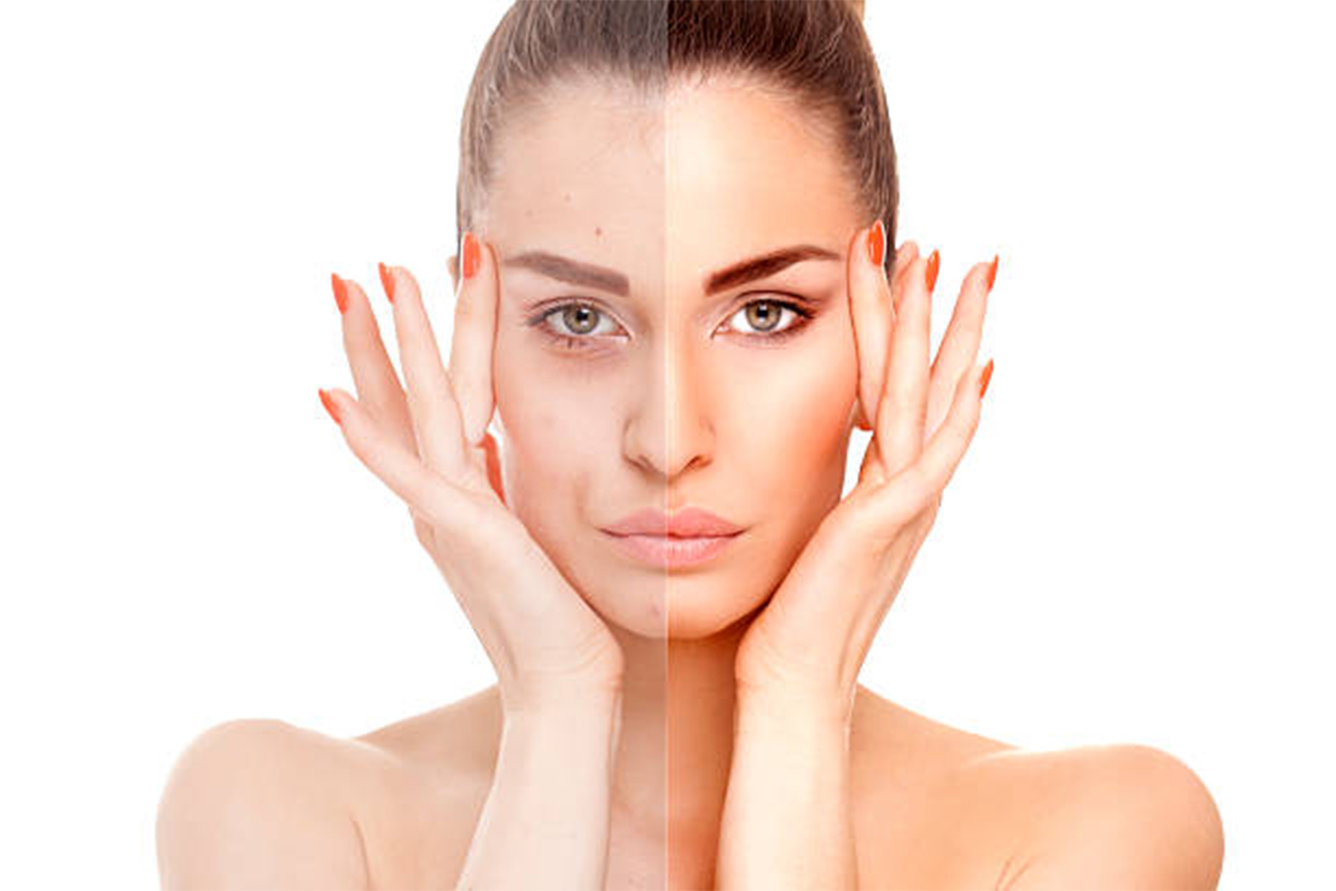 istockphoto_skin_0122