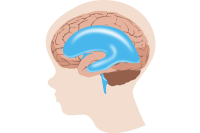 Hydrocefalus u detí: Všetko, čo by ste o tejto chorobe mali vedieť